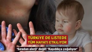 turkiye de listede tum hayati kotu etkiliyor siradan alerji degil kasidikca cogalir PpX6Sbz2.jpg